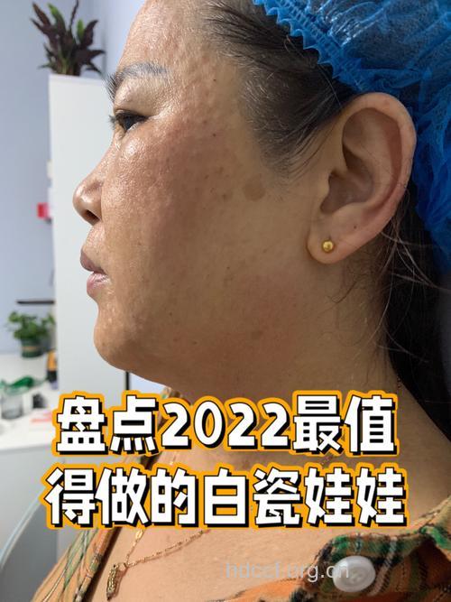 白瓷娃娃美肌嫩肤 让你告别黄脸婆