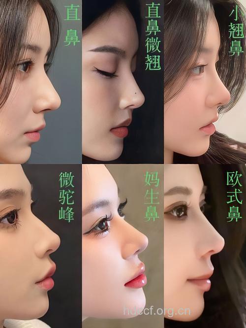 盘点属于女性的鼻部整形项目