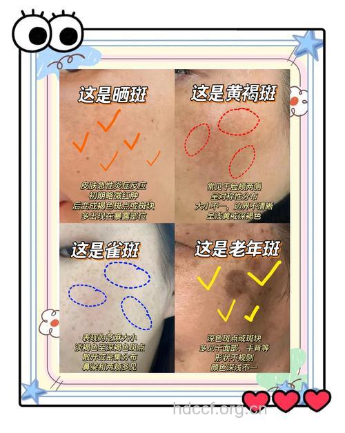 怎么做无斑美人方法