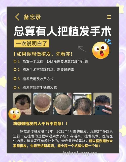 专家答疑:为什么植发又贵又疼?