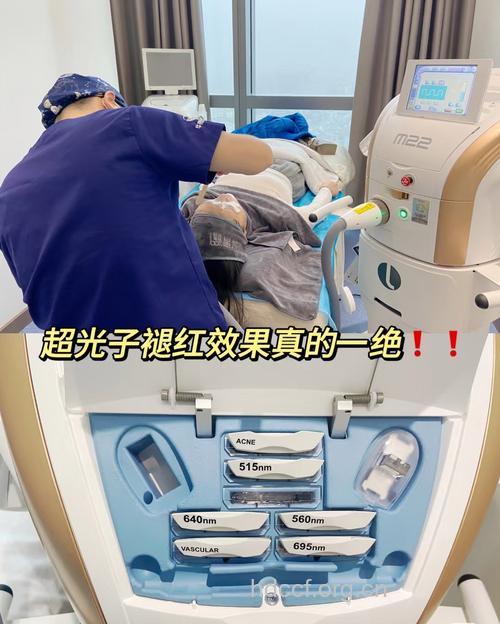 德国祛红血丝仪 帮你解决脸上红血丝烦恼