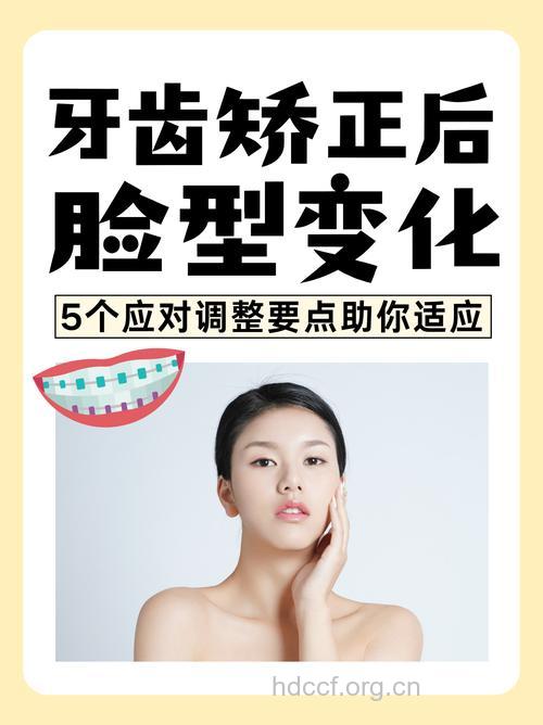 箍牙改变脸型是真的吗 实现变脸不科学