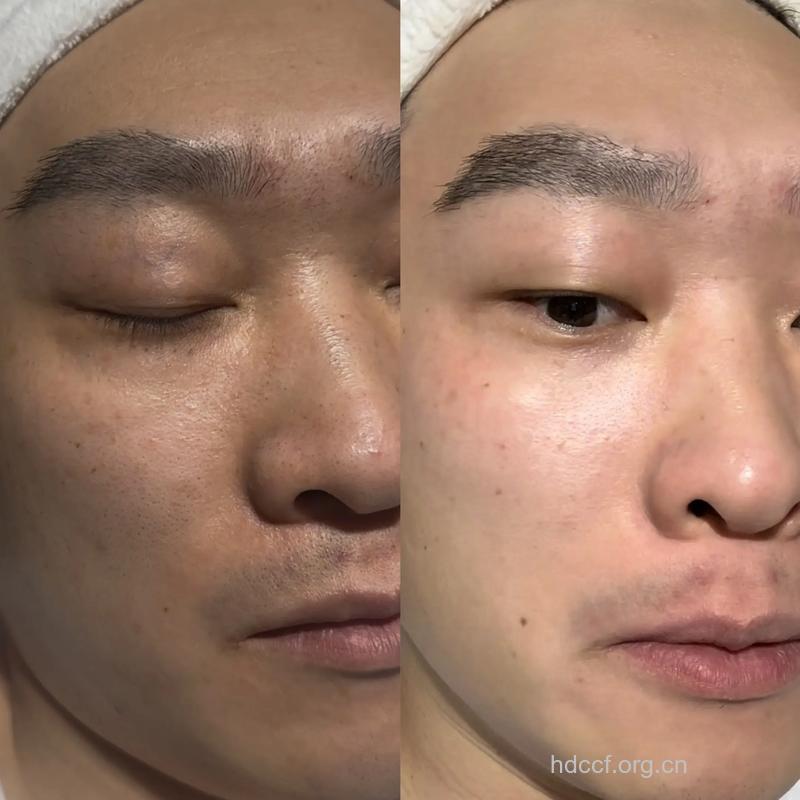 白瓷娃娃效果好吗 让你拥有美白嫩肤