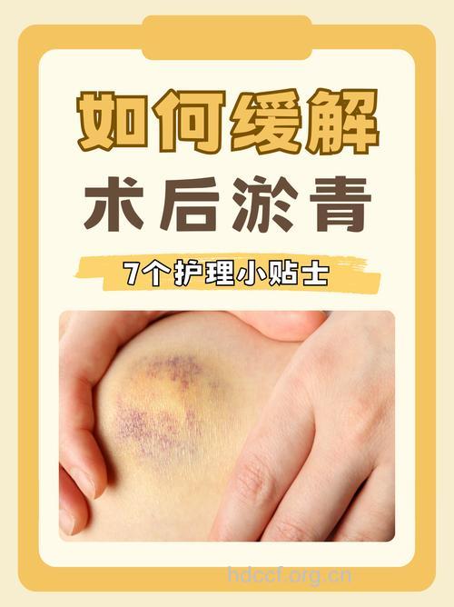 整形术后为什么有淤青 如何消除淤青