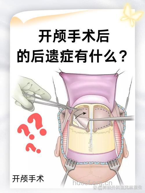 丰额头手术会有哪些风险