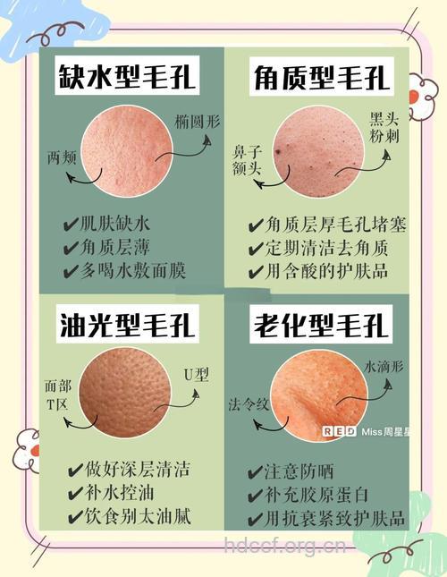日常生活缩毛孔的方法有哪些