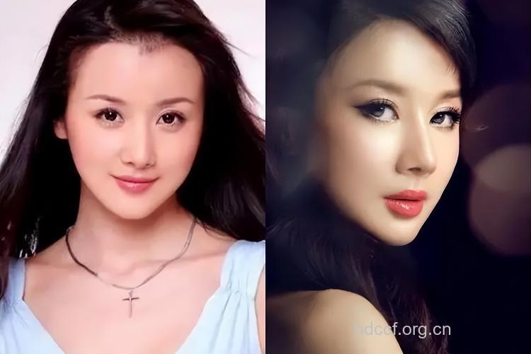 整容整上瘾 大学生白领留学生成三大整容群体