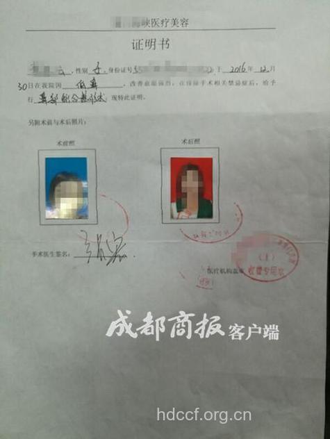 女子整容前后差别大 生活屡碰麻烦更换身份证照片