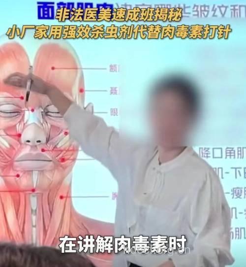 女子网购药物自行隆鼻 美容不成反毁容