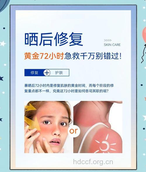 冬季防晒的重要性 晒伤时可以这么做