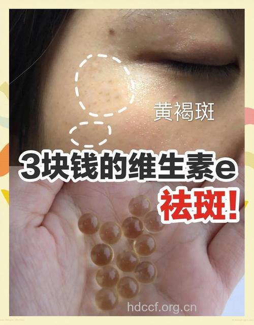 维生素E是如何祛斑的