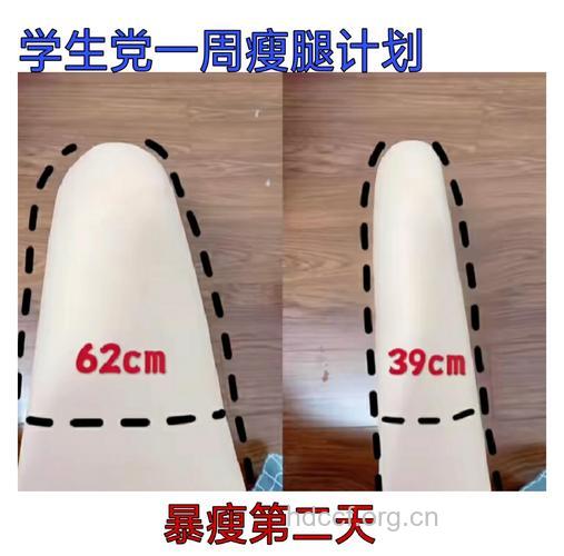 准大学生花万元“抽脂瘦腿” 专家提醒切忌盲从