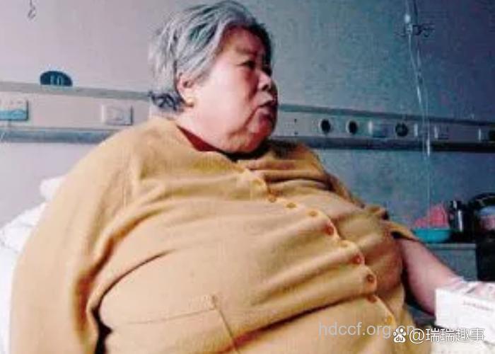七旬老太疯狂减肥 一月减肥22斤致截瘫