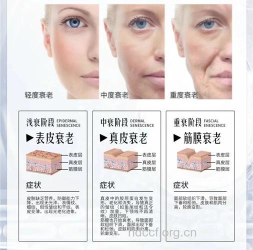 面部肌肤衰老排行榜 有你吗