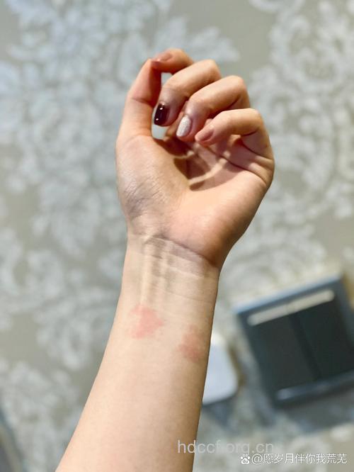 显示器也可导致皮肤过敏