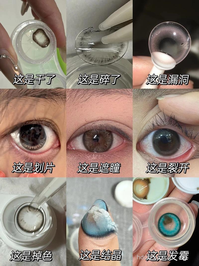 美瞳镜片系“三无”产品 易引发各种眼病