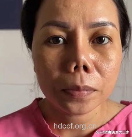 学生为升学求职求爱热衷整容 整形专家劝阻
