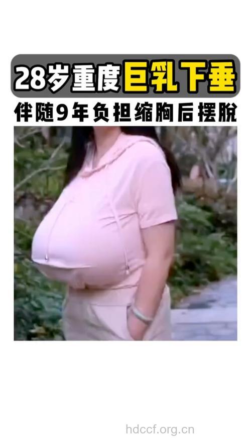 中国第一波霸:巨乳是种病