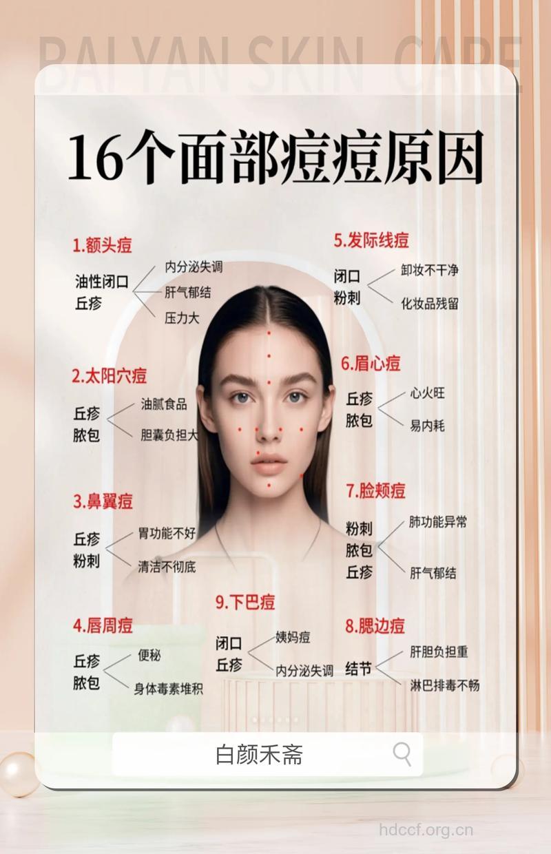 脸上为什么会长痘痘