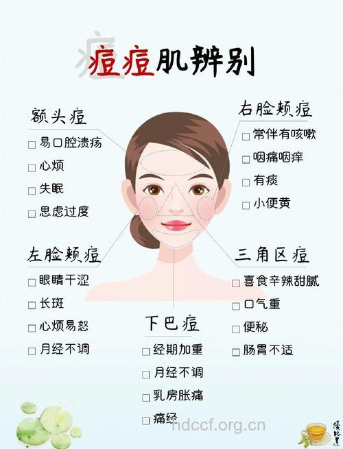 冬天易长痘 祛痘也要分区域