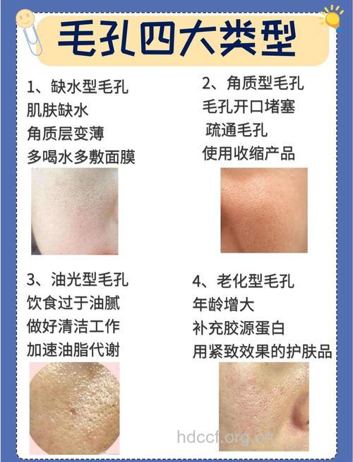 毛孔问题影响着你的美丽