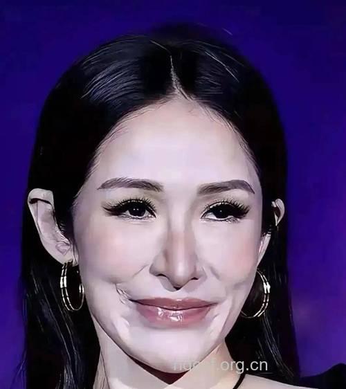 面部整容失败率到底有多高?
