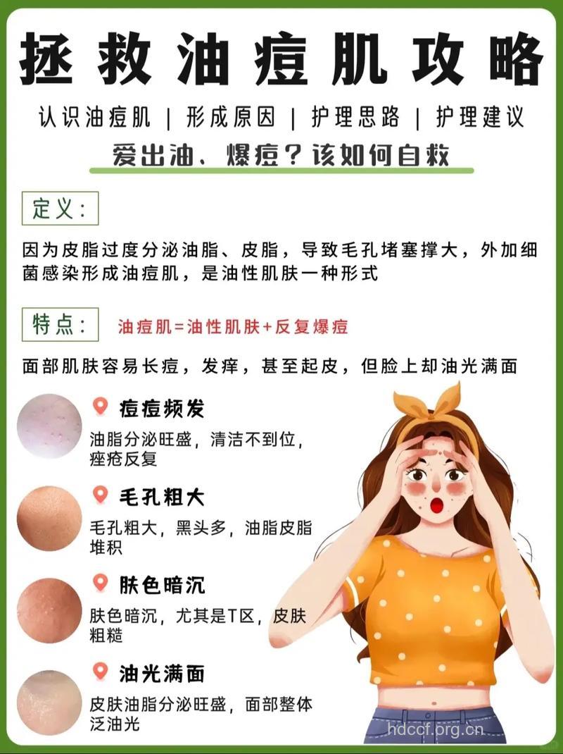 油性痘痘肌如何正确护肤