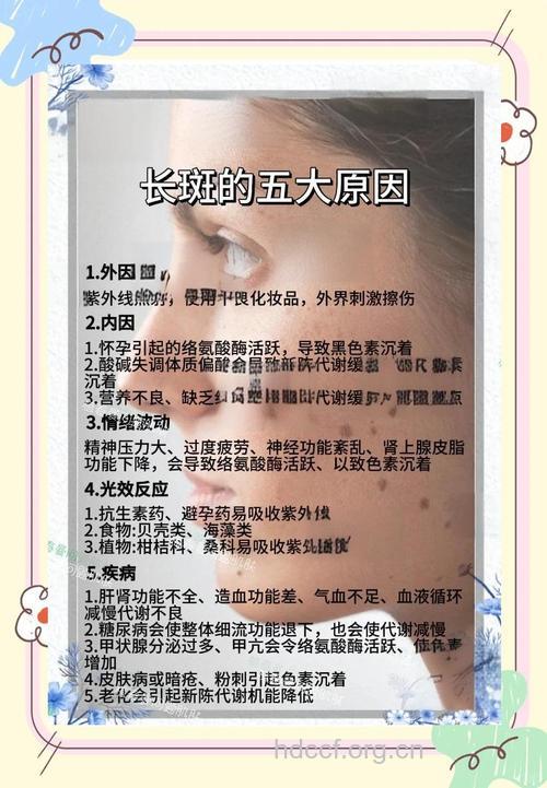 女人你知道你的斑是怎么来的吗