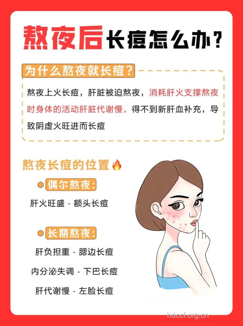 晚睡族怎么应对痘痘问题