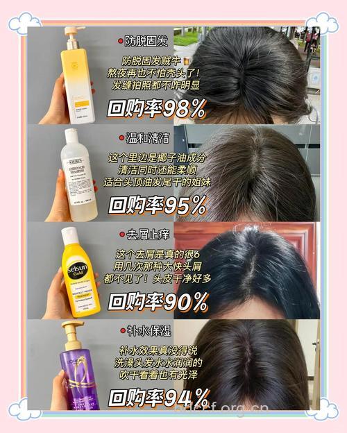 防脱发 从日常洗护入手