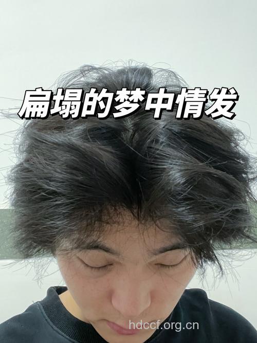 最伤人的“美发”谎言