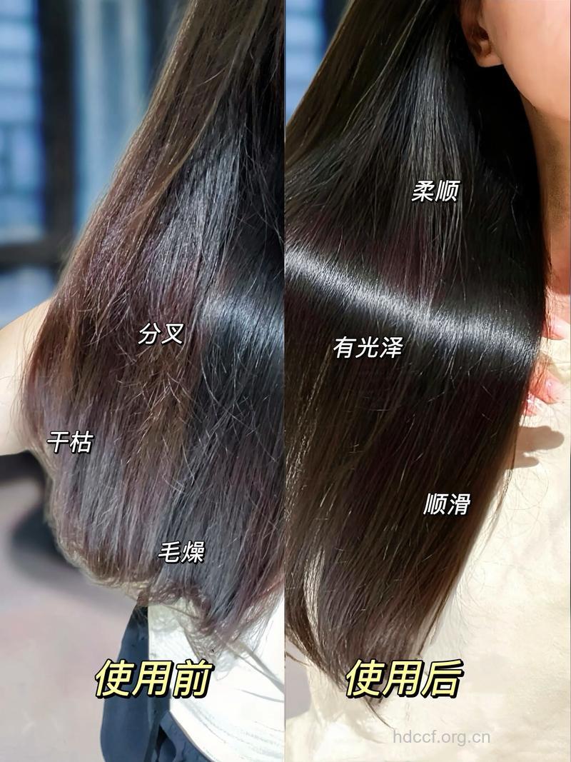 头发容易开叉怎么办？