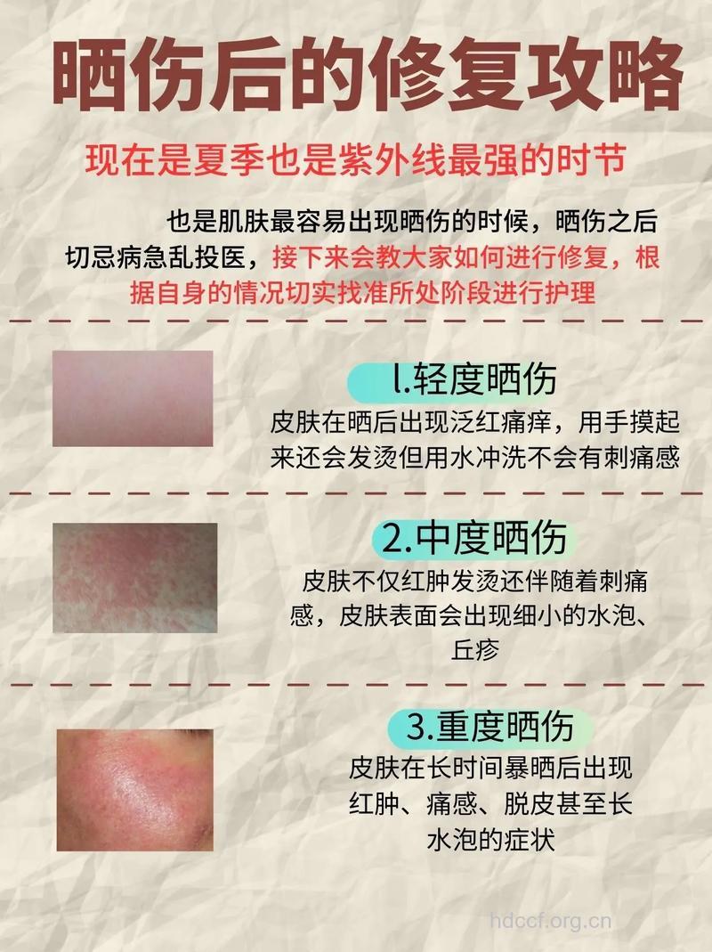 夏季如何修复晒伤秀发