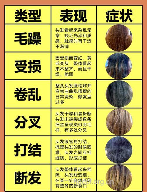 头发常见四大问题 教你如何护理