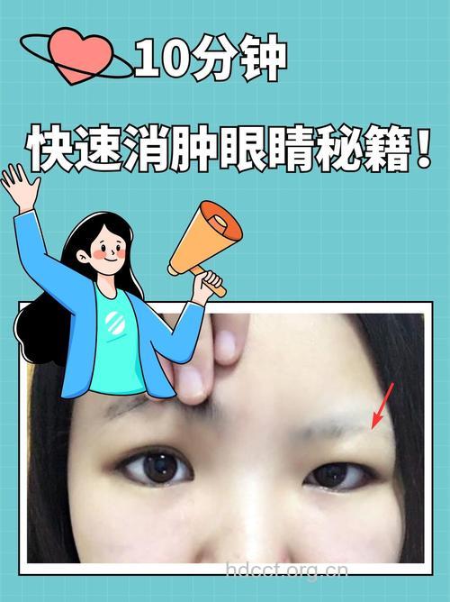 有哪些搞定眼部眼部浮肿