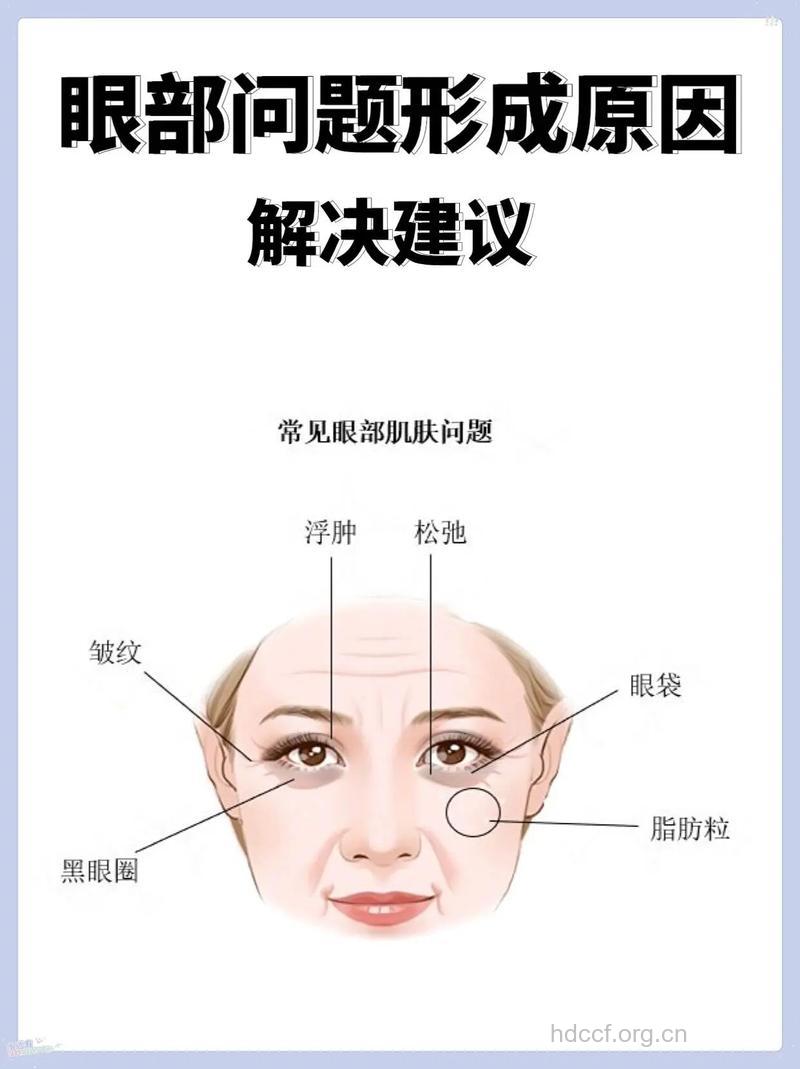 怎么解决眼周肌肤的问题