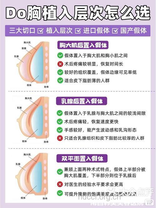 假体隆胸有哪些步骤