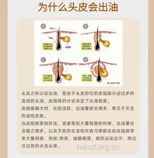 怎么保护头皮健康方法