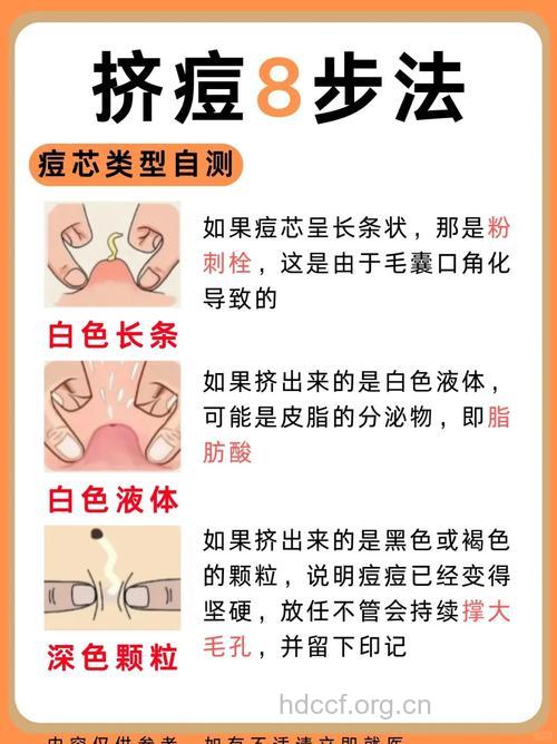 怎么样挤痘不留痘疤