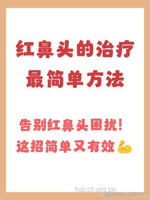 红鼻头是如何形成的 护理红鼻头有好方法