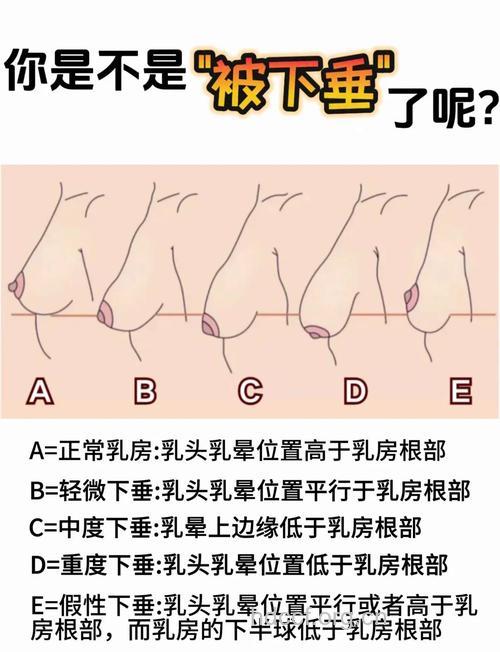 哪些坏习惯会导致胸部下垂