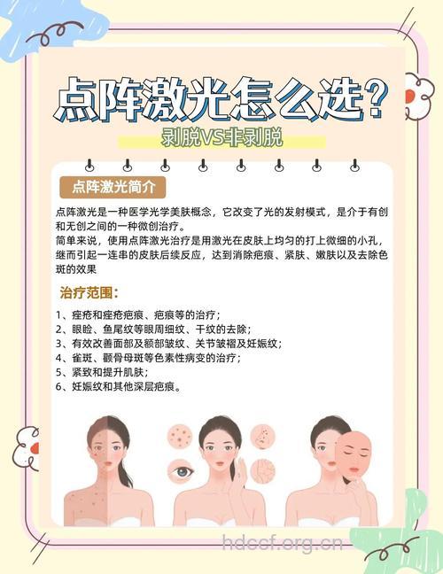 激光脱毛的5大优势