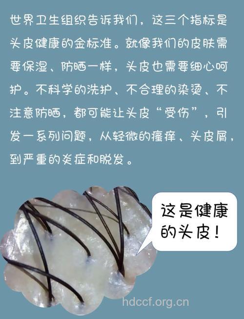 头皮健康有哪些常识
