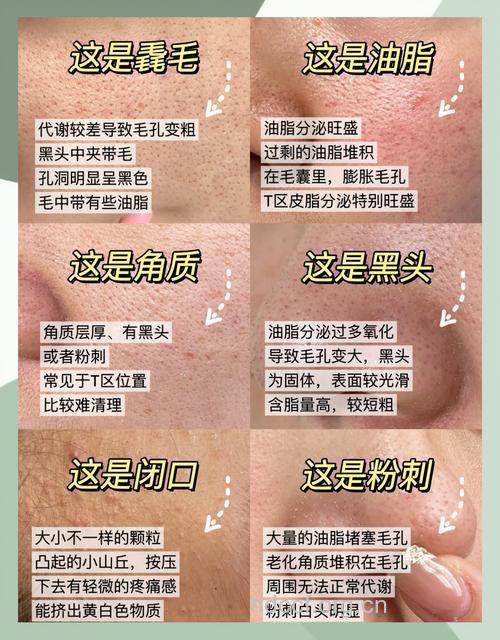 找准病因 简单收缩毛孔