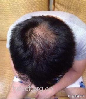 男士有哪些护理秀发的原则