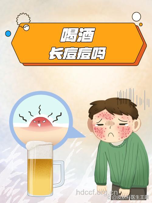 长痘小常识 喝酒会导致脸上长痘痘吗