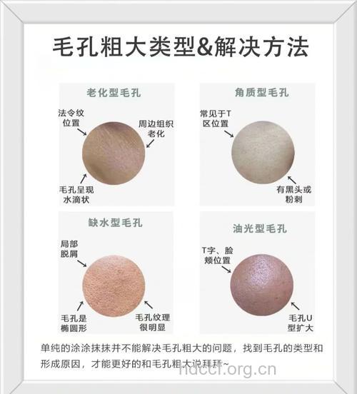 毛孔粗大是大问题 五大习惯还原细嫩肌