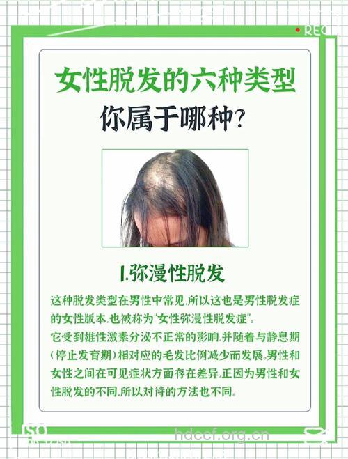 造成女性脱发的原因都有哪些呢？
