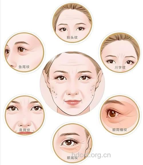 四种皮肤最容易衰老 女人如何抗衰老