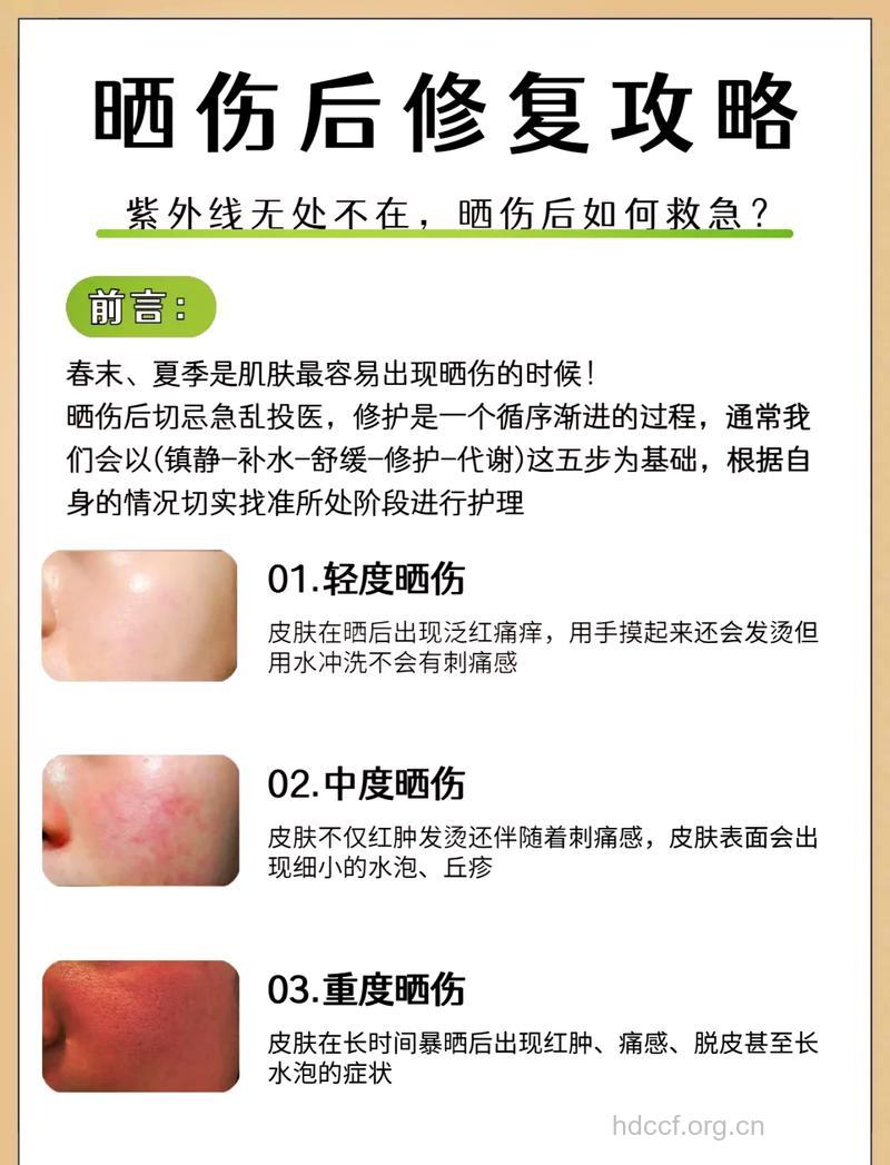 夏季晒后怎么镇定皮肤